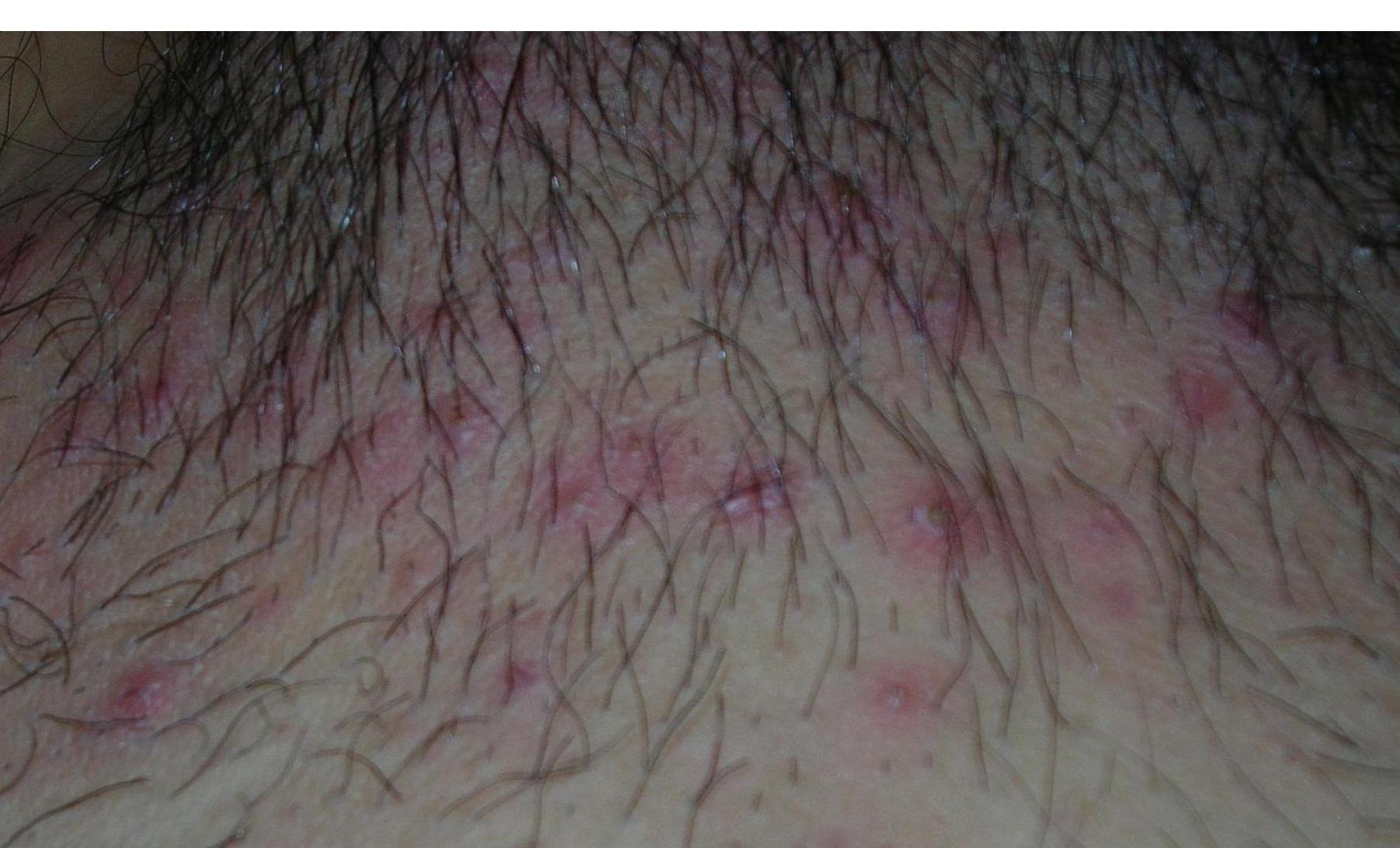 ESkin - 皮膚璺到底】