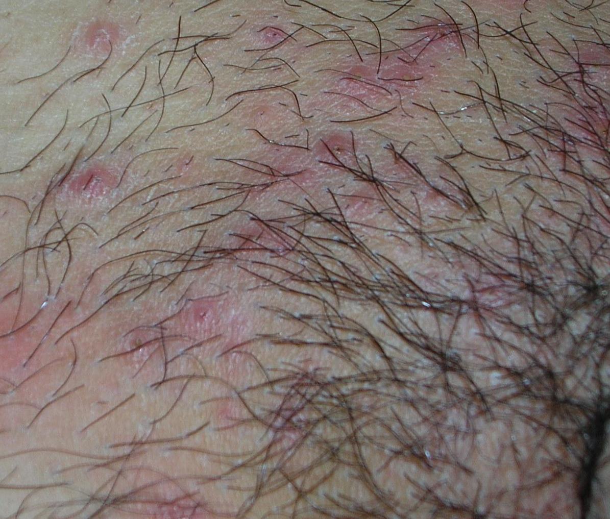 ESkin - 皮膚璺到底】